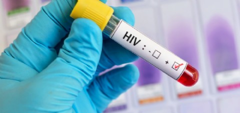 Los casos de VIH en Ecuador han aumentado en los últimos dos años